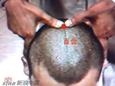 艾灸常用的保健穴有哪些？--百會