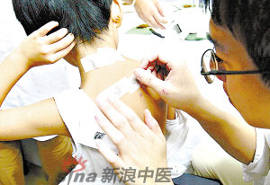 灸法的種類  你知道多少？