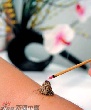 節(jié)氣灸” 冬至，你灸了嗎？